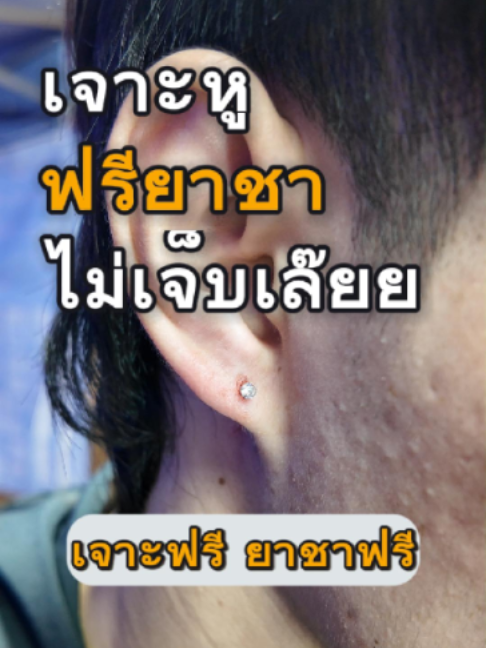 @ฟลุ๊ค
