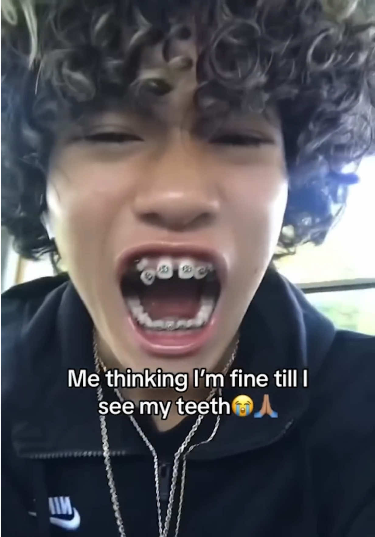 @Thebentist