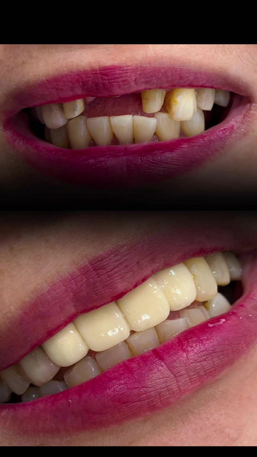 @Pearly Smile