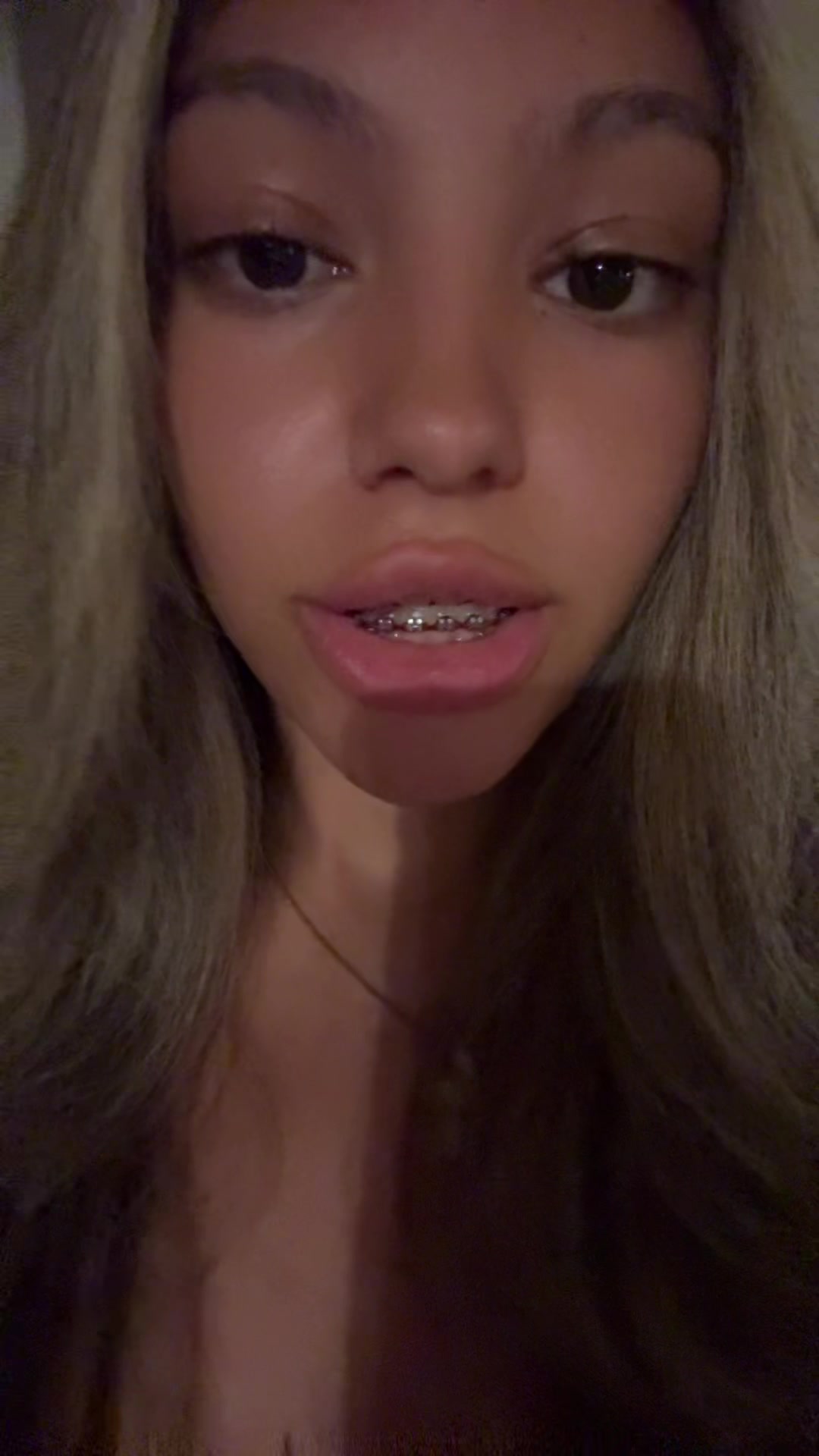@Shae