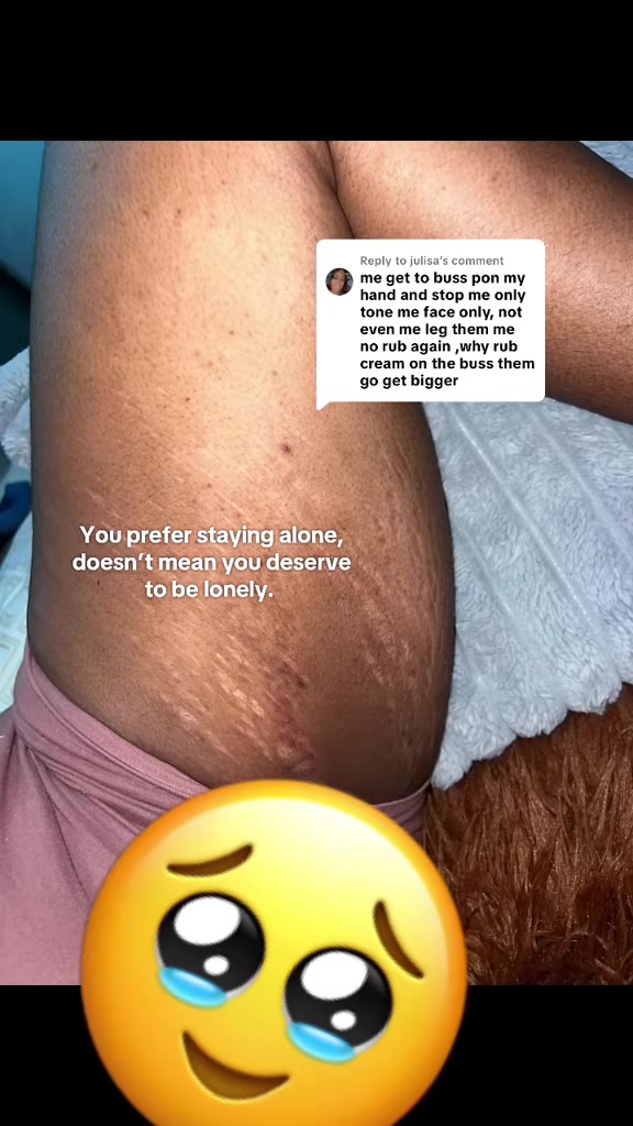 @Stretch_markeraser