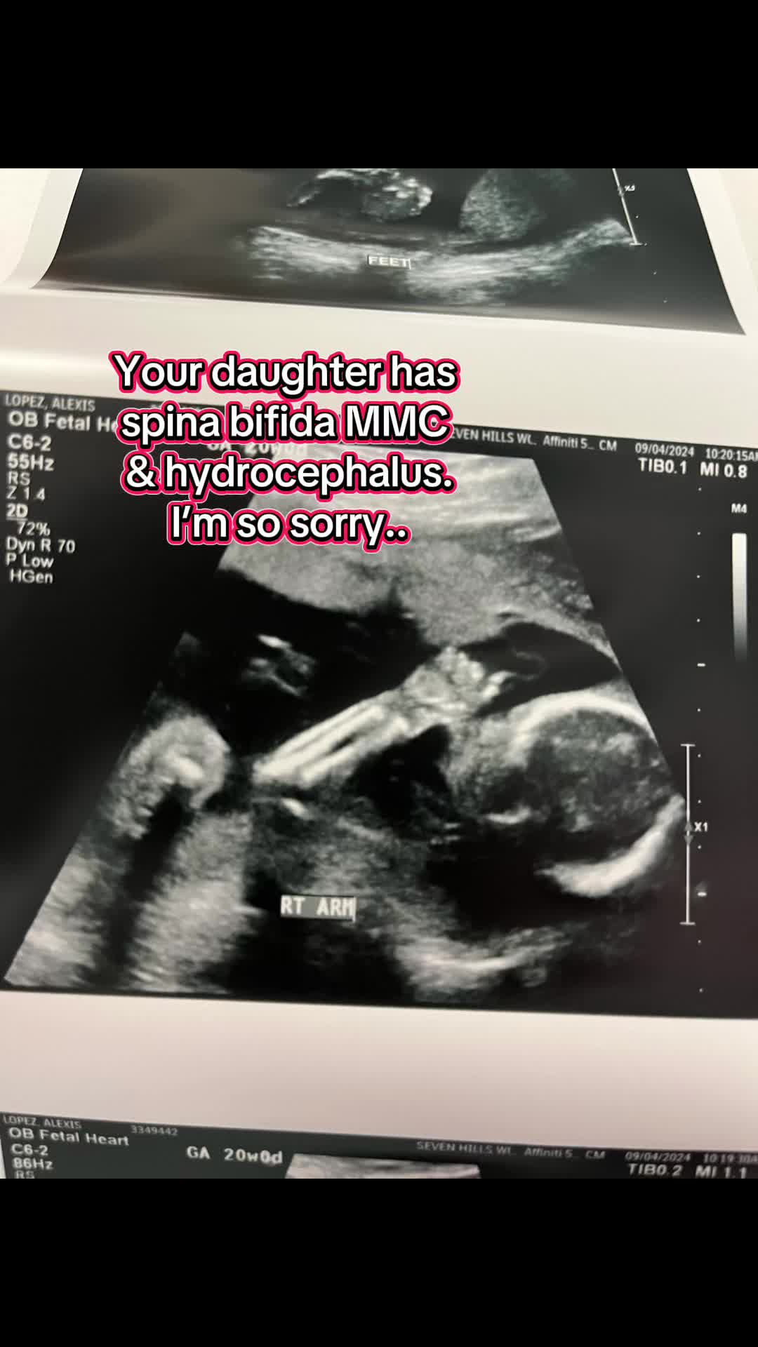 @Lexy | SB Momma🎗️