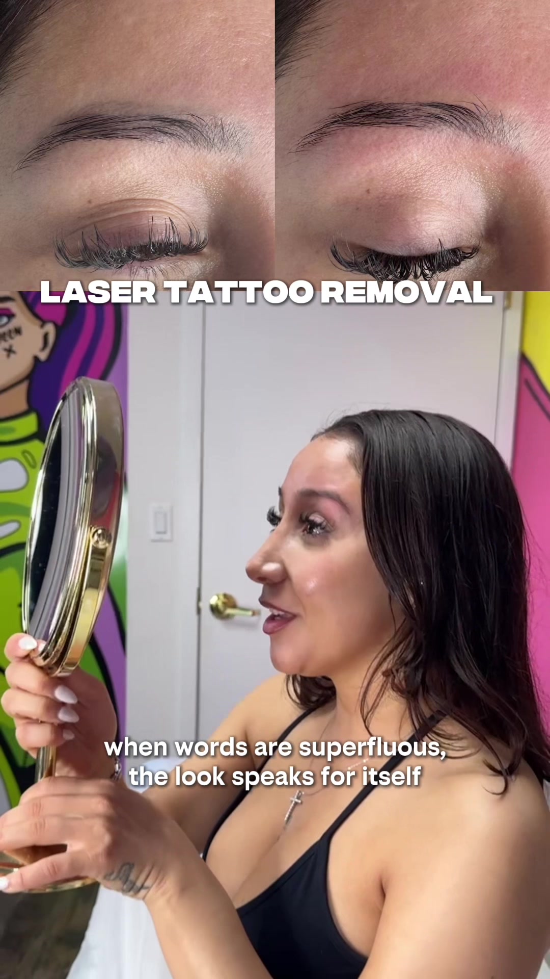 @Safe Eyebrows Tattoo Removal🗽