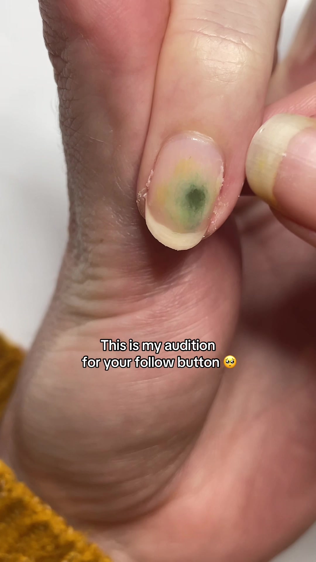 @Tappy Tips | Nail Artist ๐ป