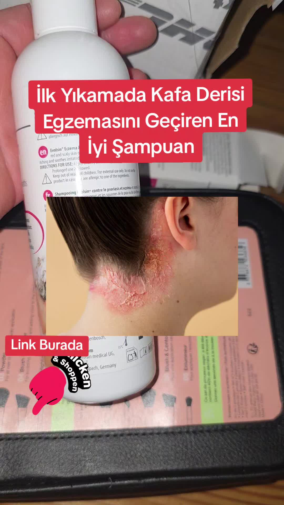 @Gurbetana27