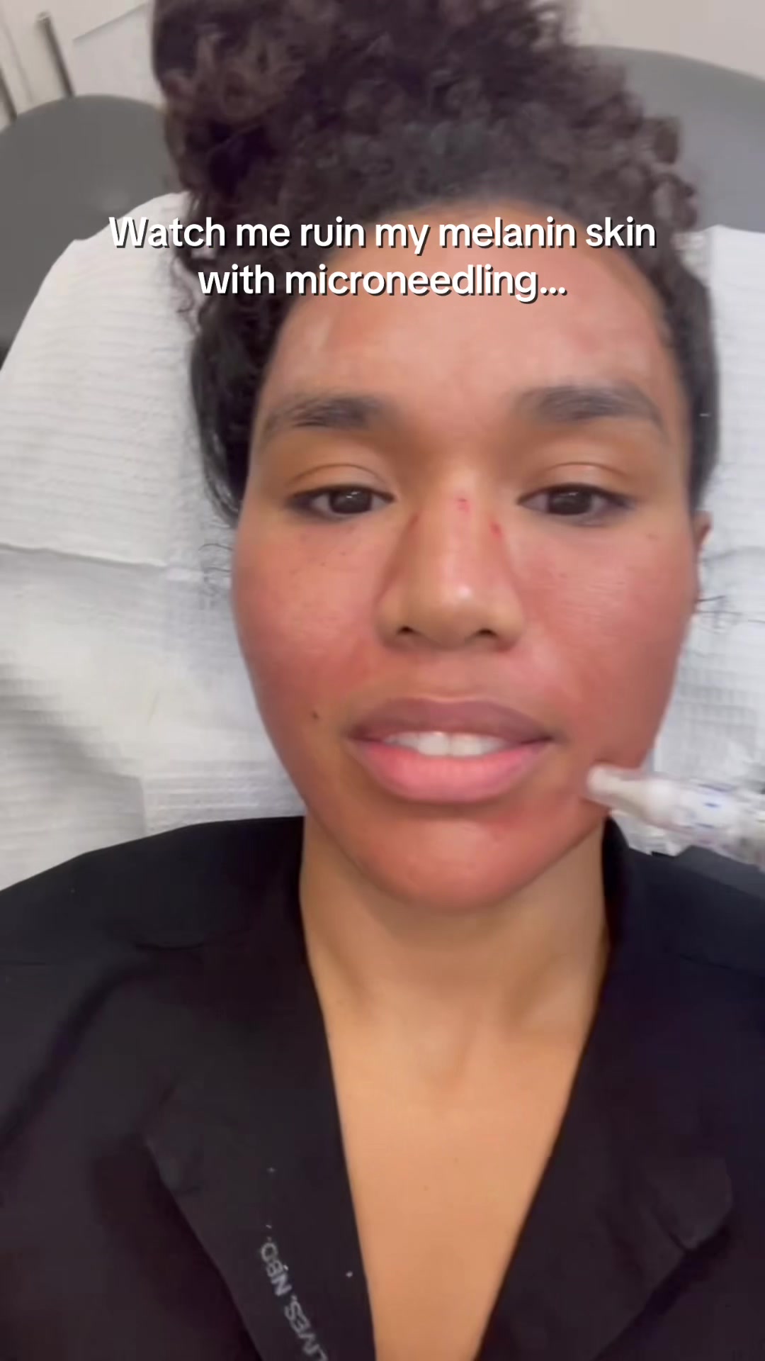 @Botox Filler Skin Los Angeles