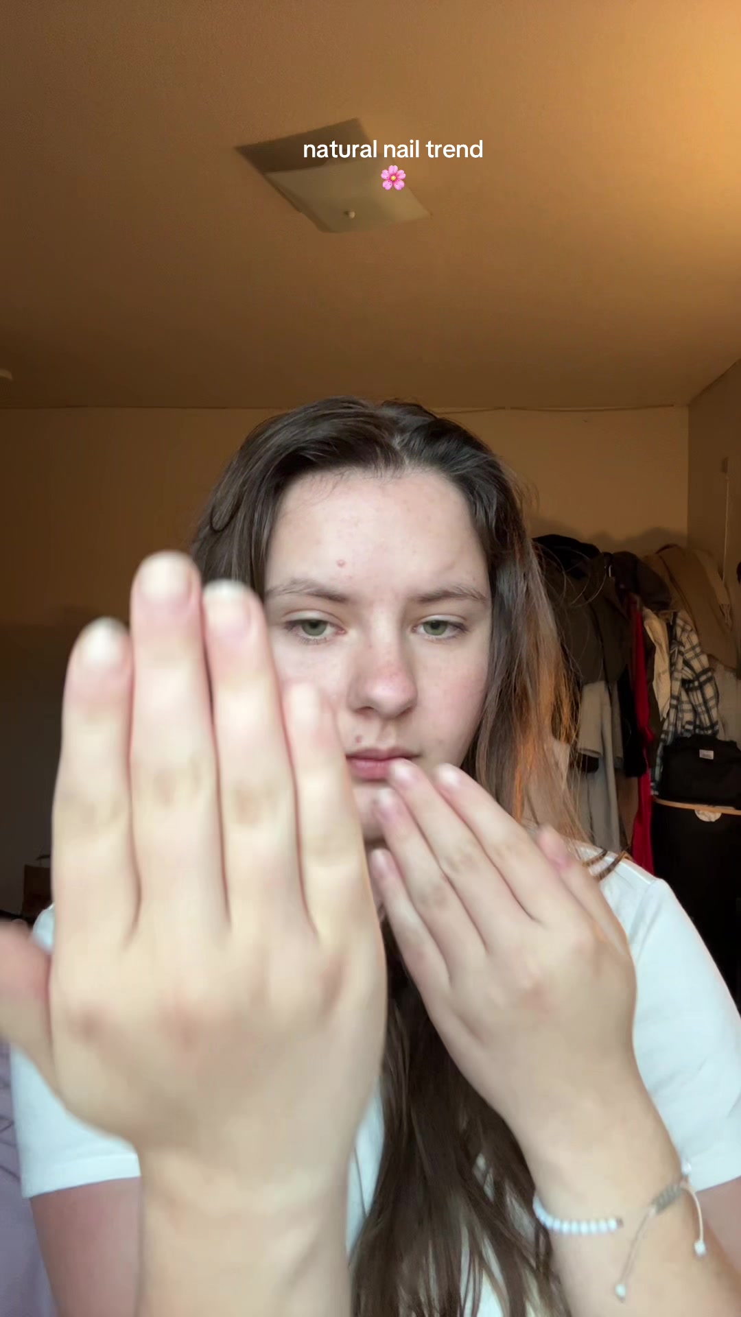 @em