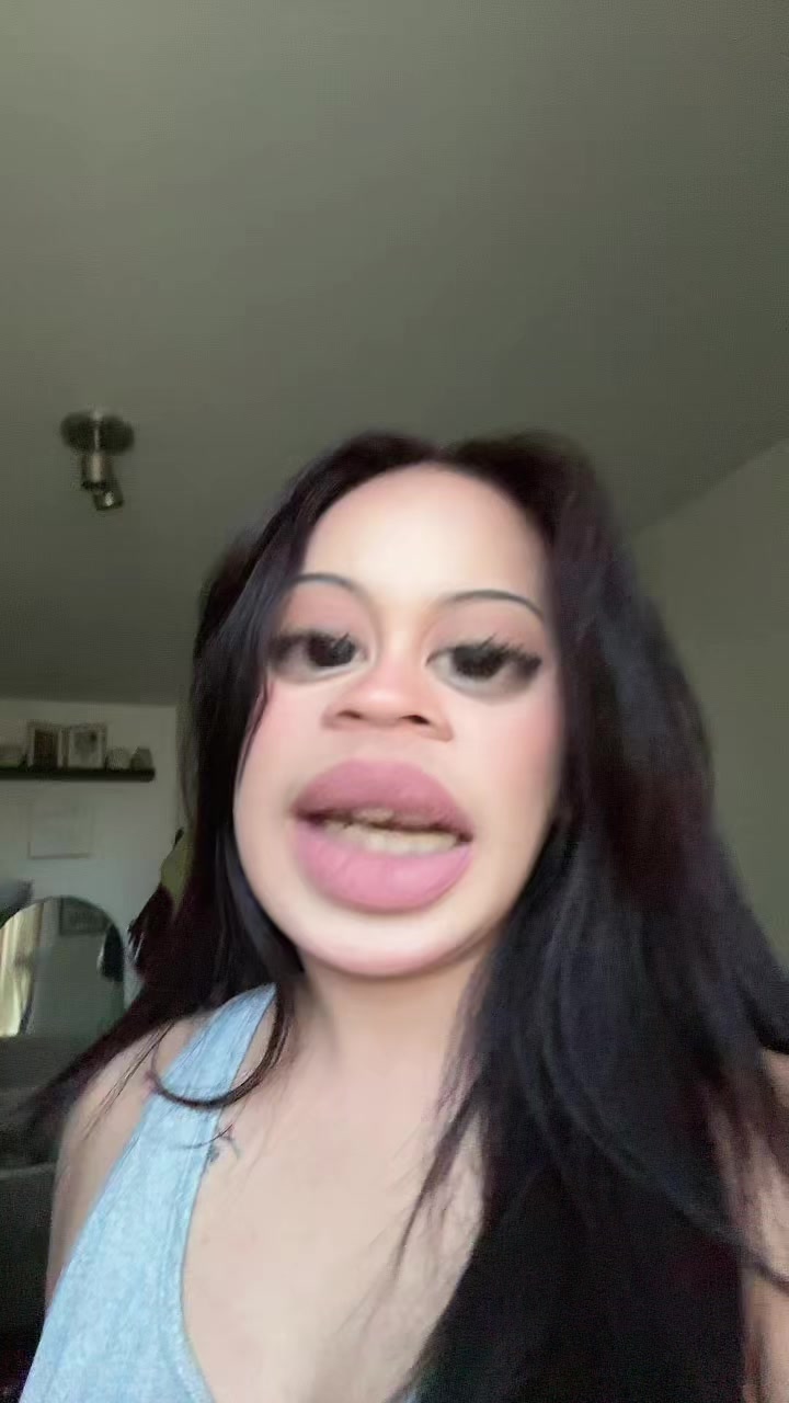 @🍒