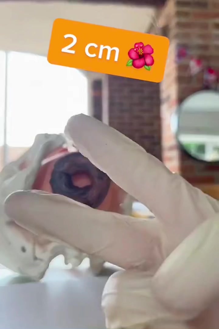 @UG health tipstv