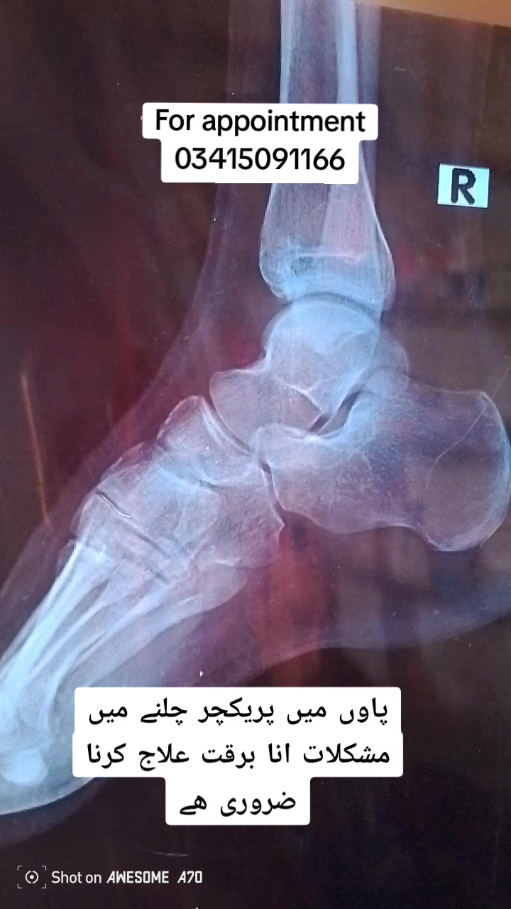 @Dr wadood