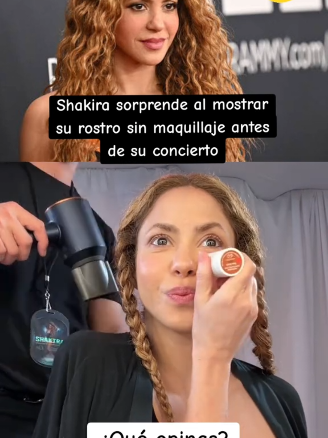 @Omar Moller