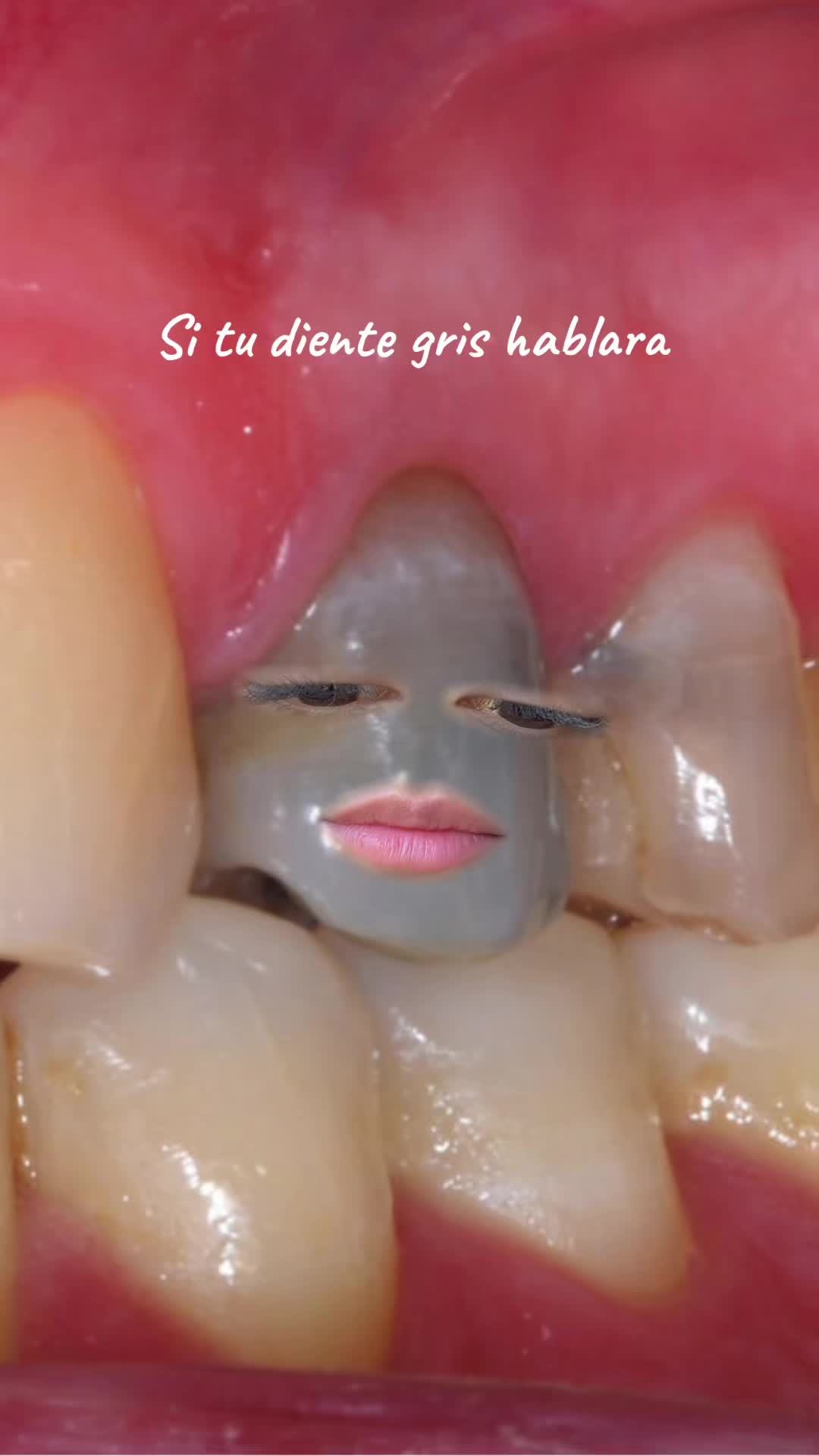 @Dental Vanydent