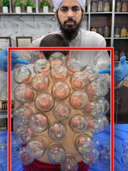 @Doctor & Hijama Cupping Clinic