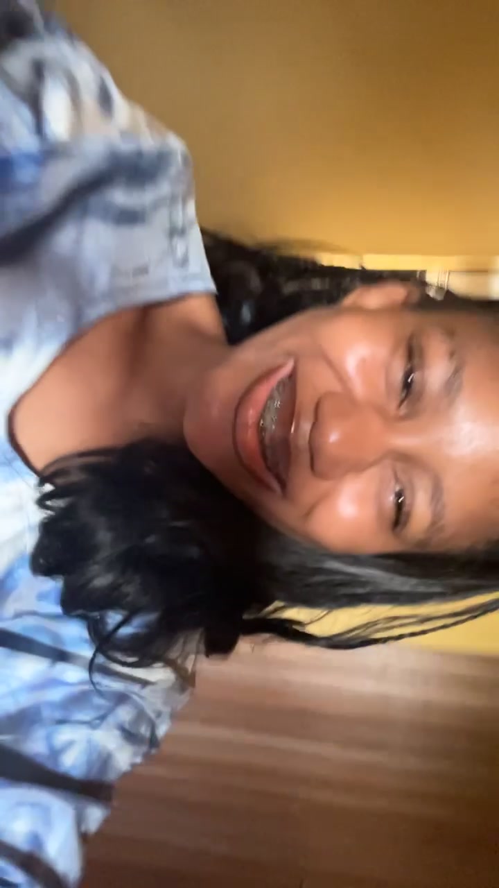 @Brace face 🥴