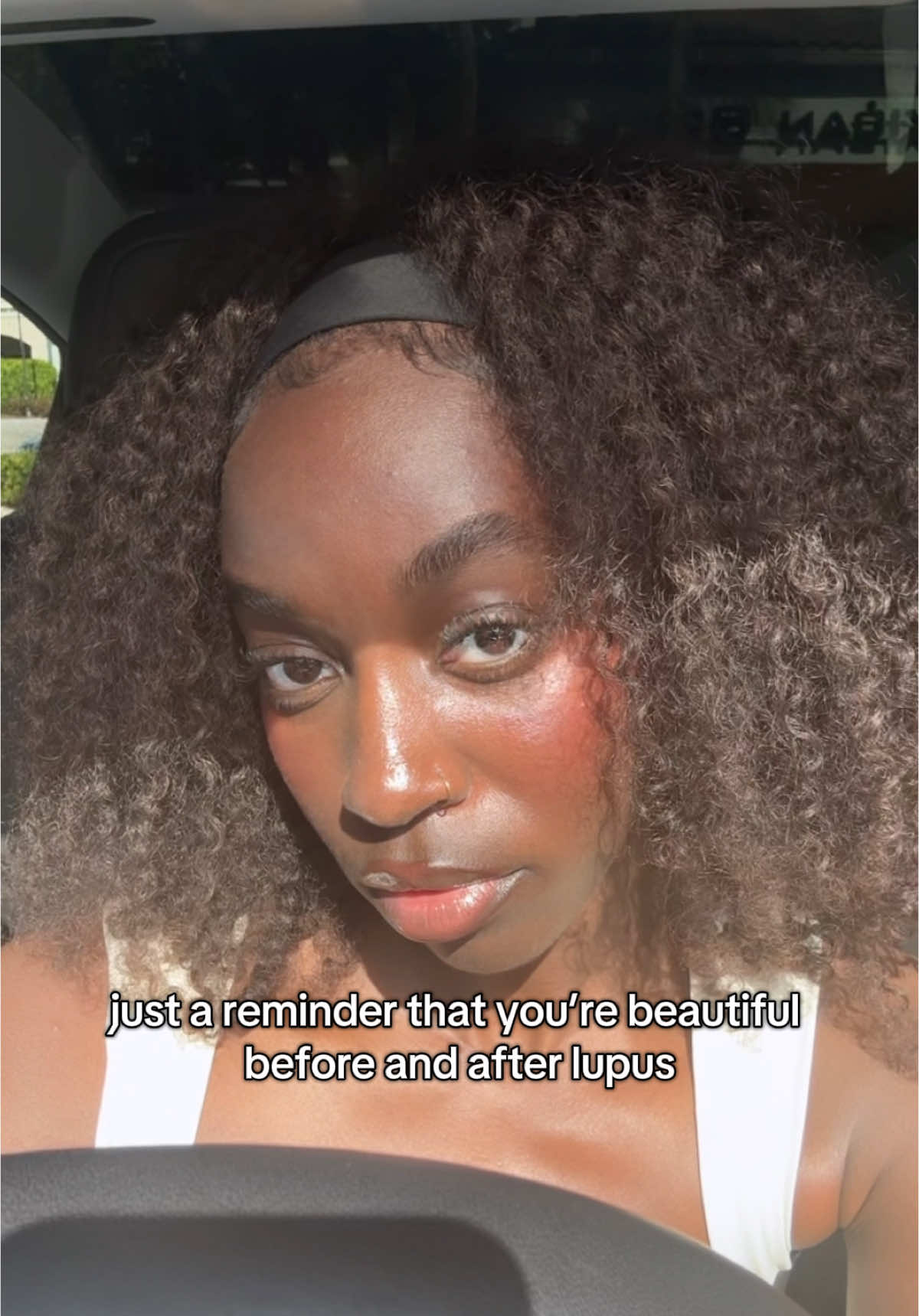 @jeneva | lupus warrior