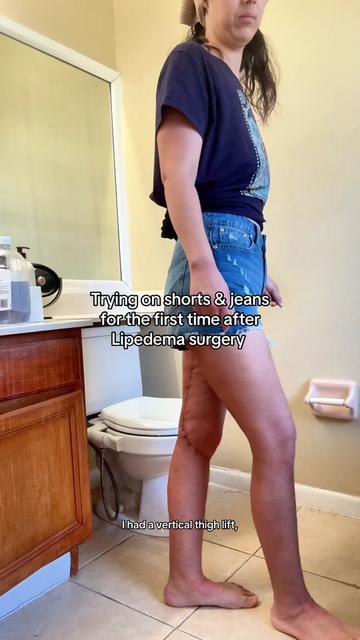 @Heather 𖤓 PCOS Princess