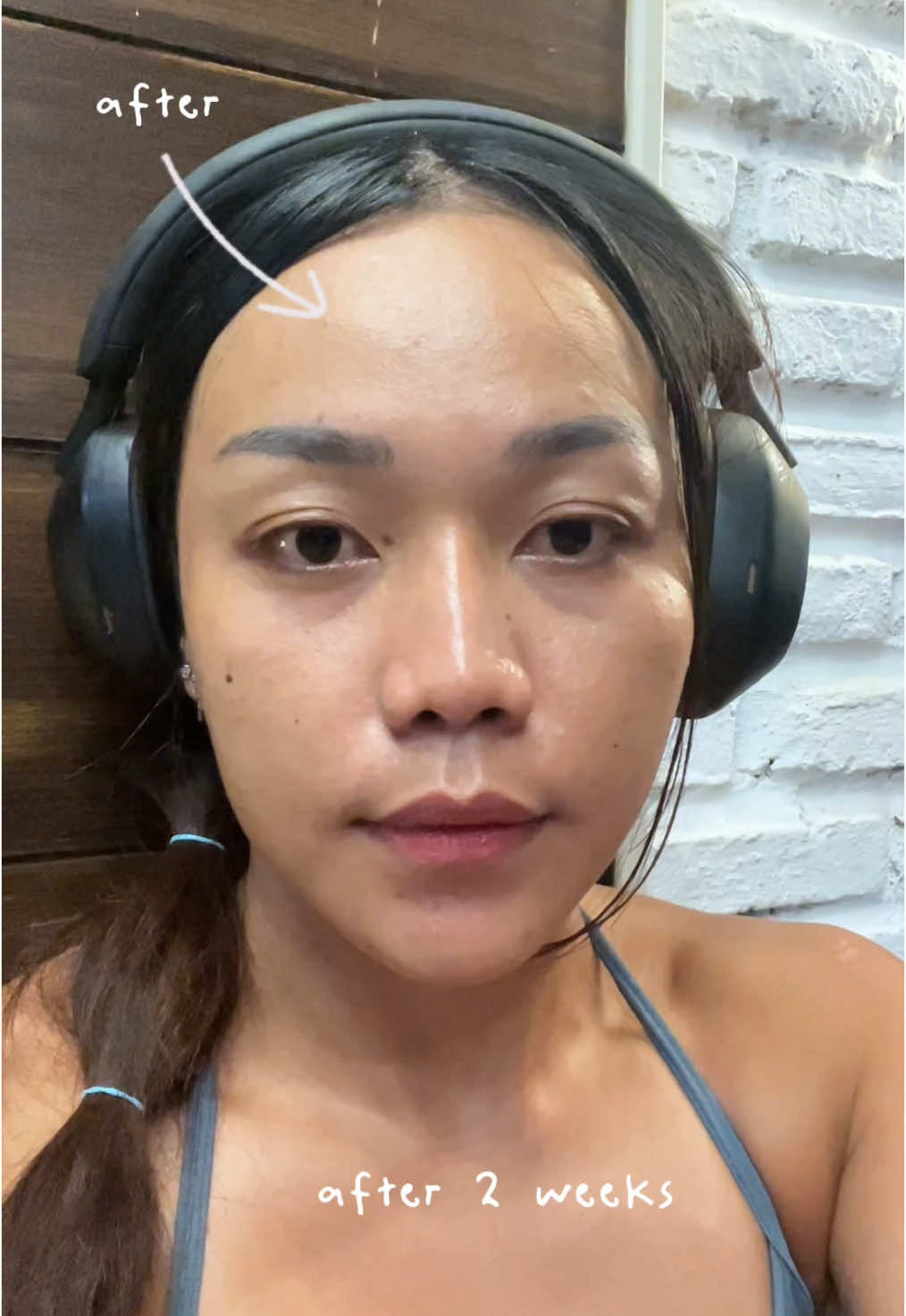 @Anin