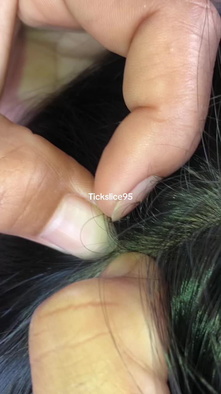@Tickslice95