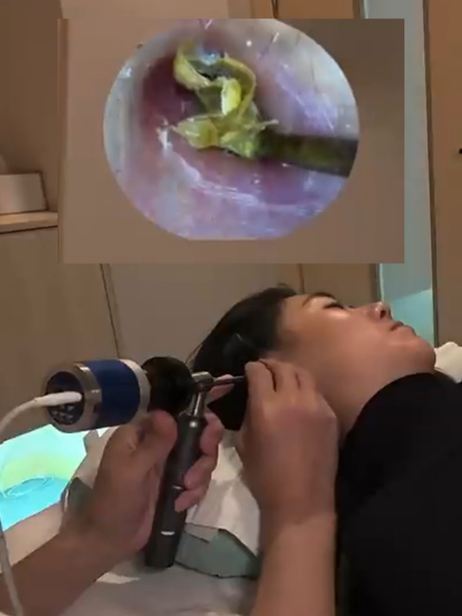 @ASMR Ear Cleaning