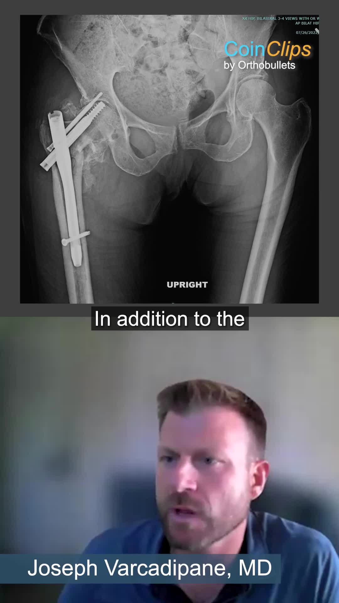 @Orthobullets