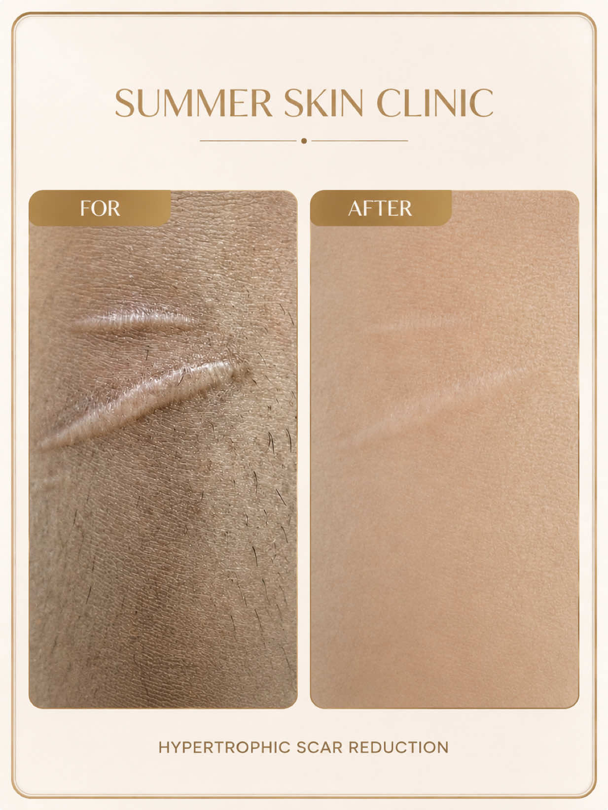 @Summer Skin Clinic | Toronto