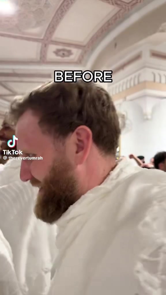 @CT