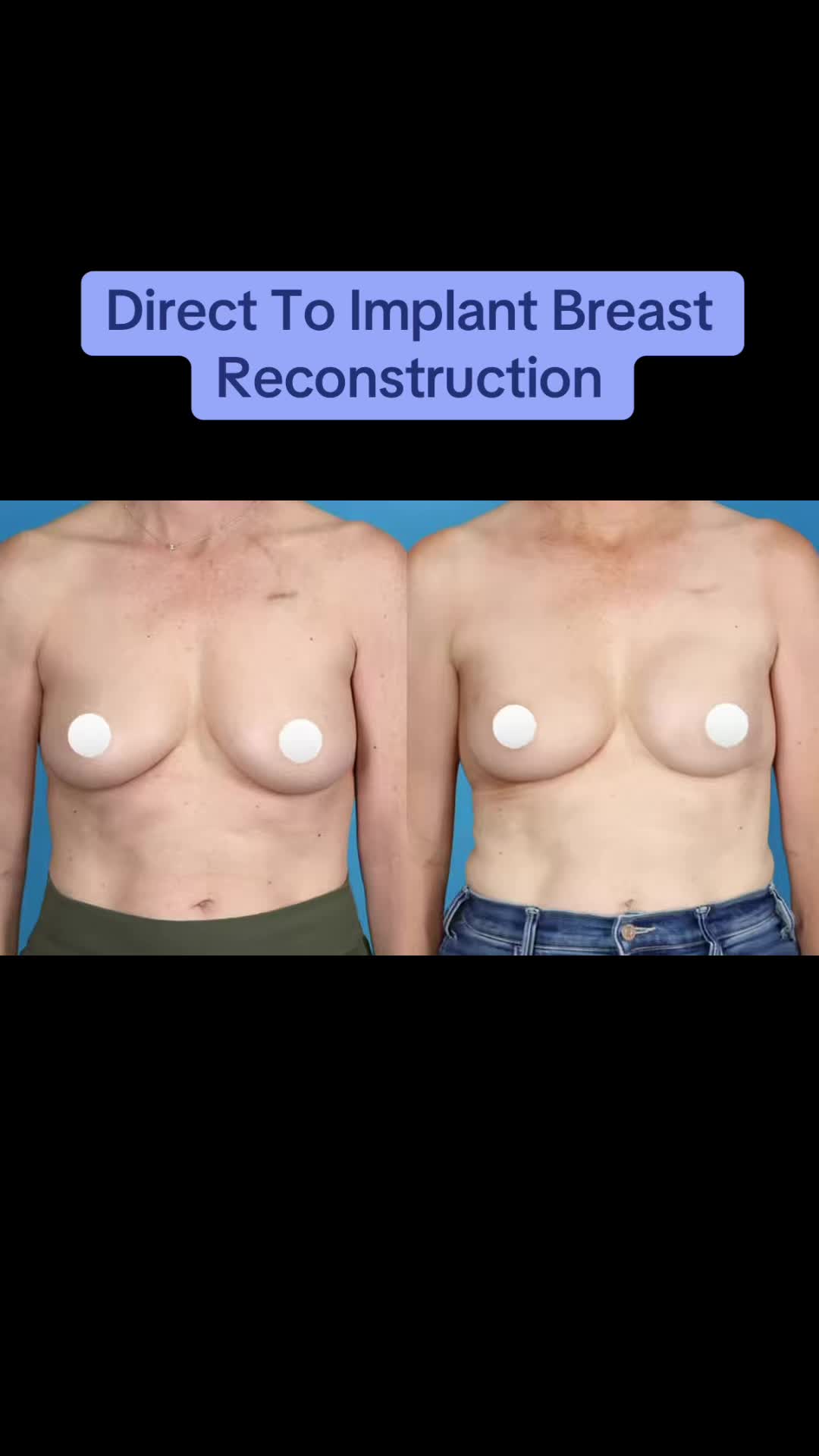@Kelly&ensp;Killeen,&ensp;MD,&ensp;FACS