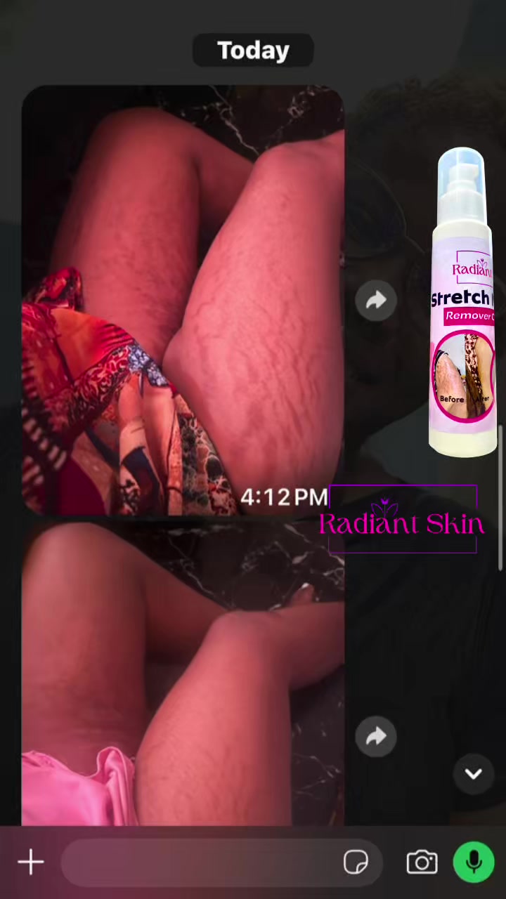 @Radiant skin