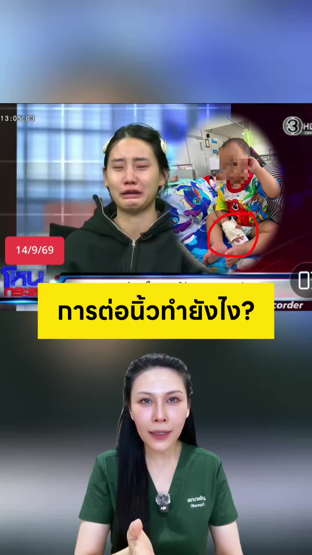 @พยาบาลอัญ