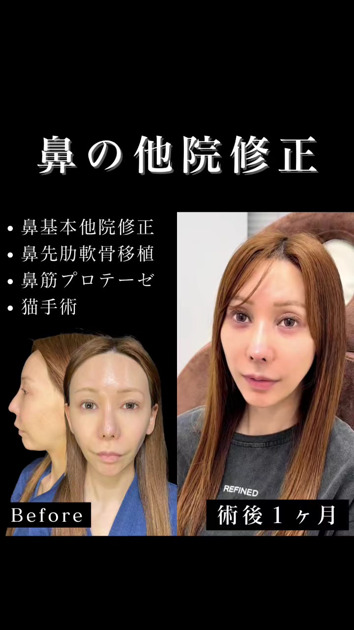 @ソ院長(バウム美容外科/トータル整形)
