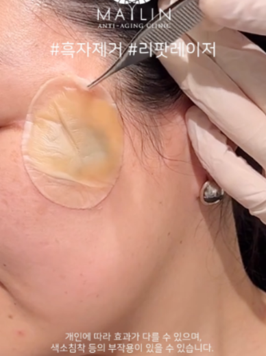 @메이린의원대구점