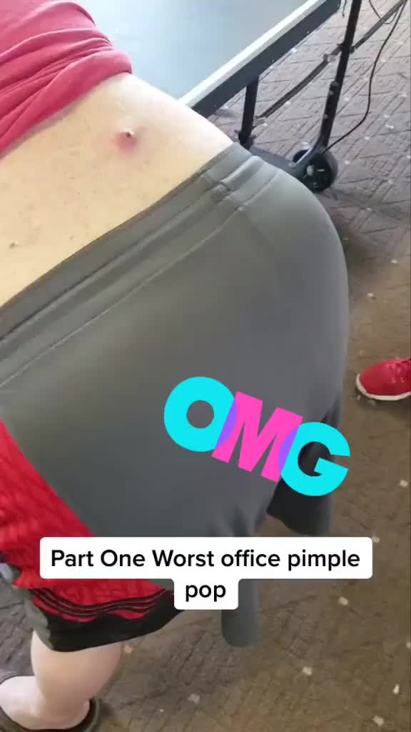@Pimple Pooping