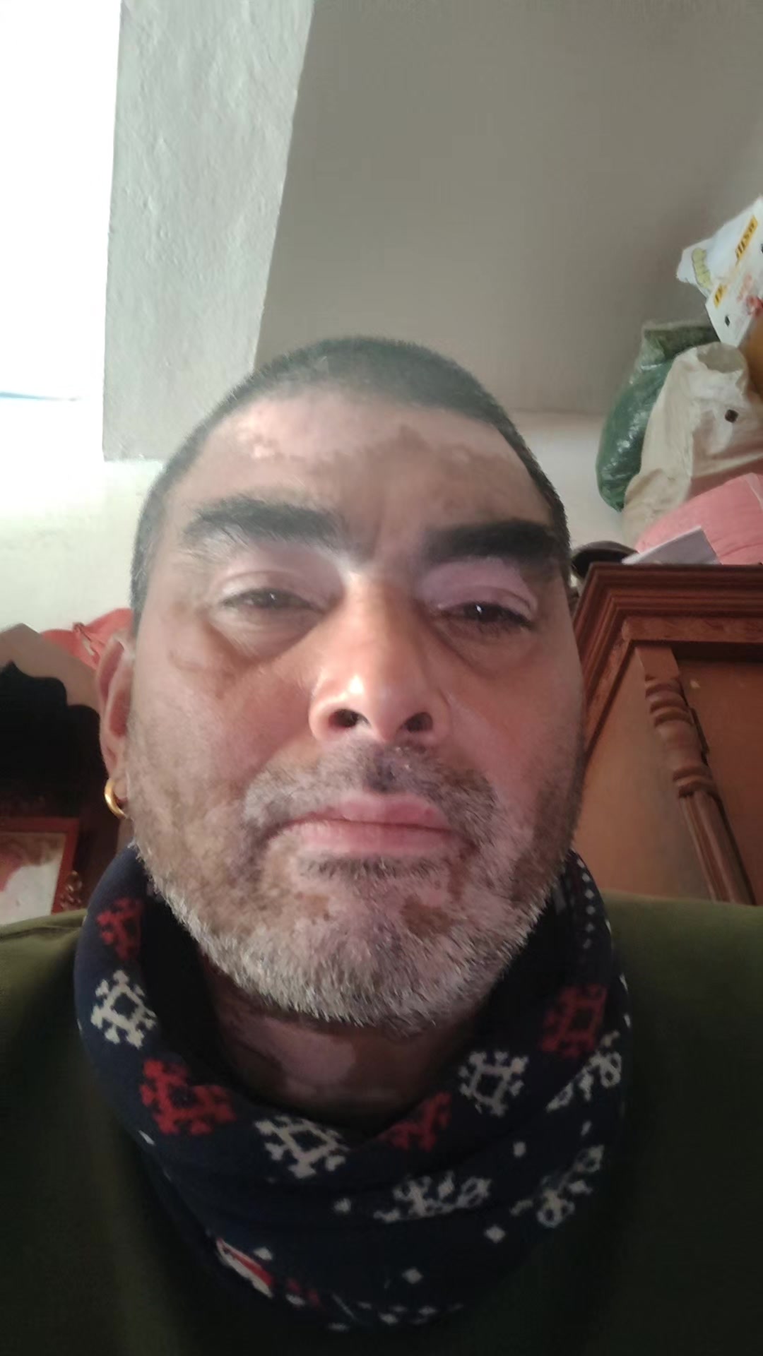 @Bhakta Lal Shrestha