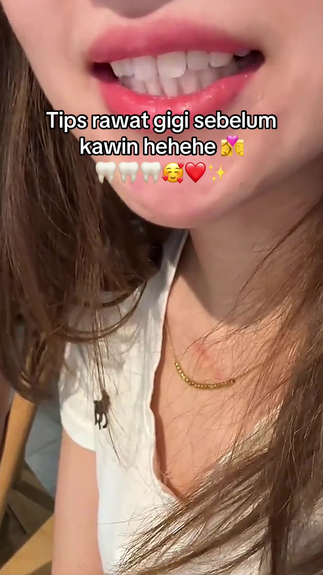 @Gigi Putih Berkilau🦷✨