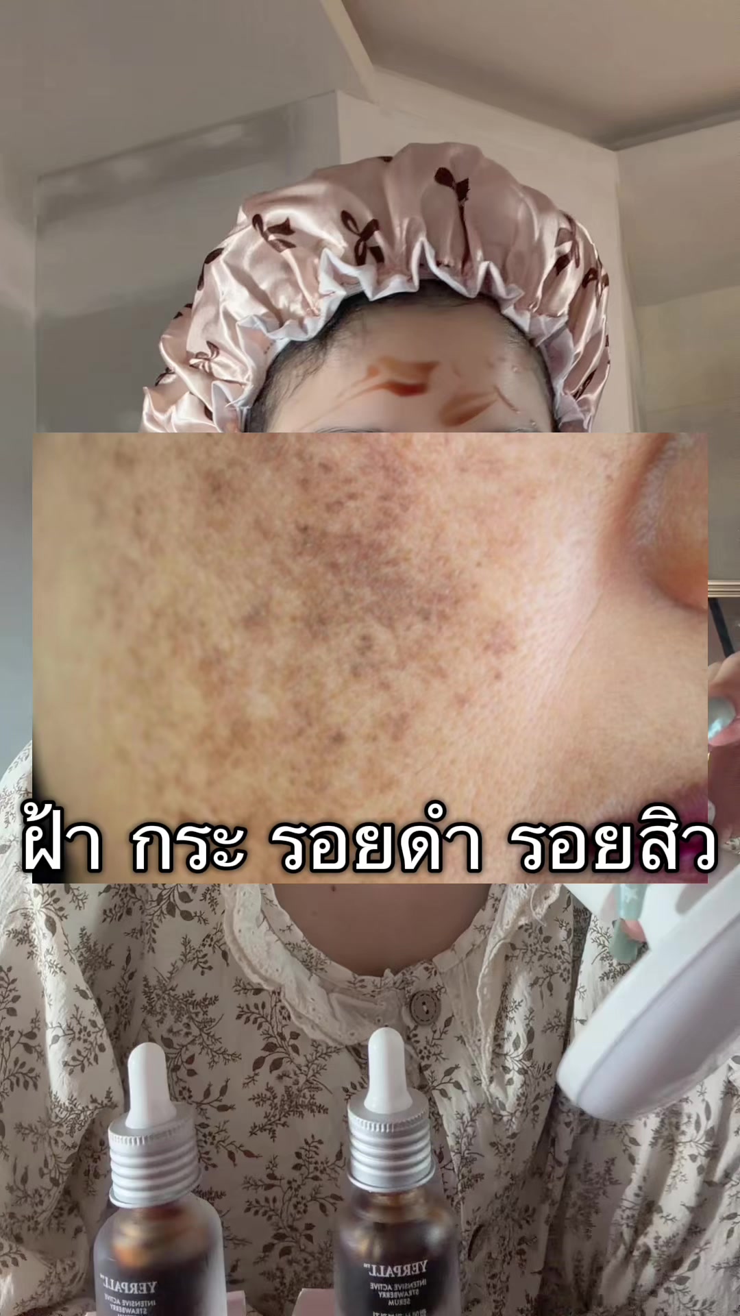 @ฝน สิจะได้คม🔪