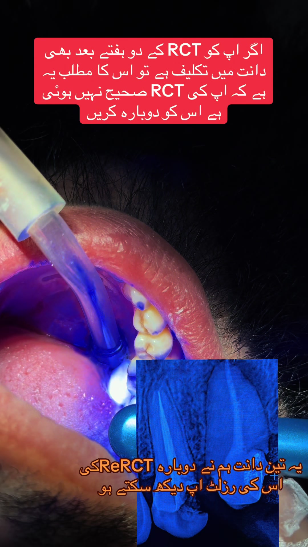 @Dr Hammad| Dental Surgeon