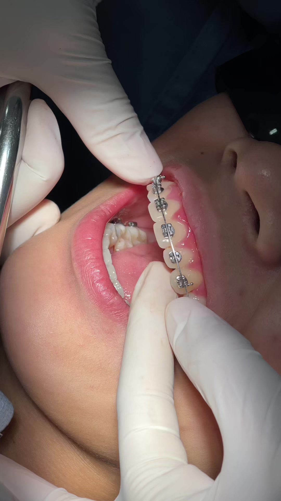 @BRIGHT SMILE DENTAL HOSPITAL