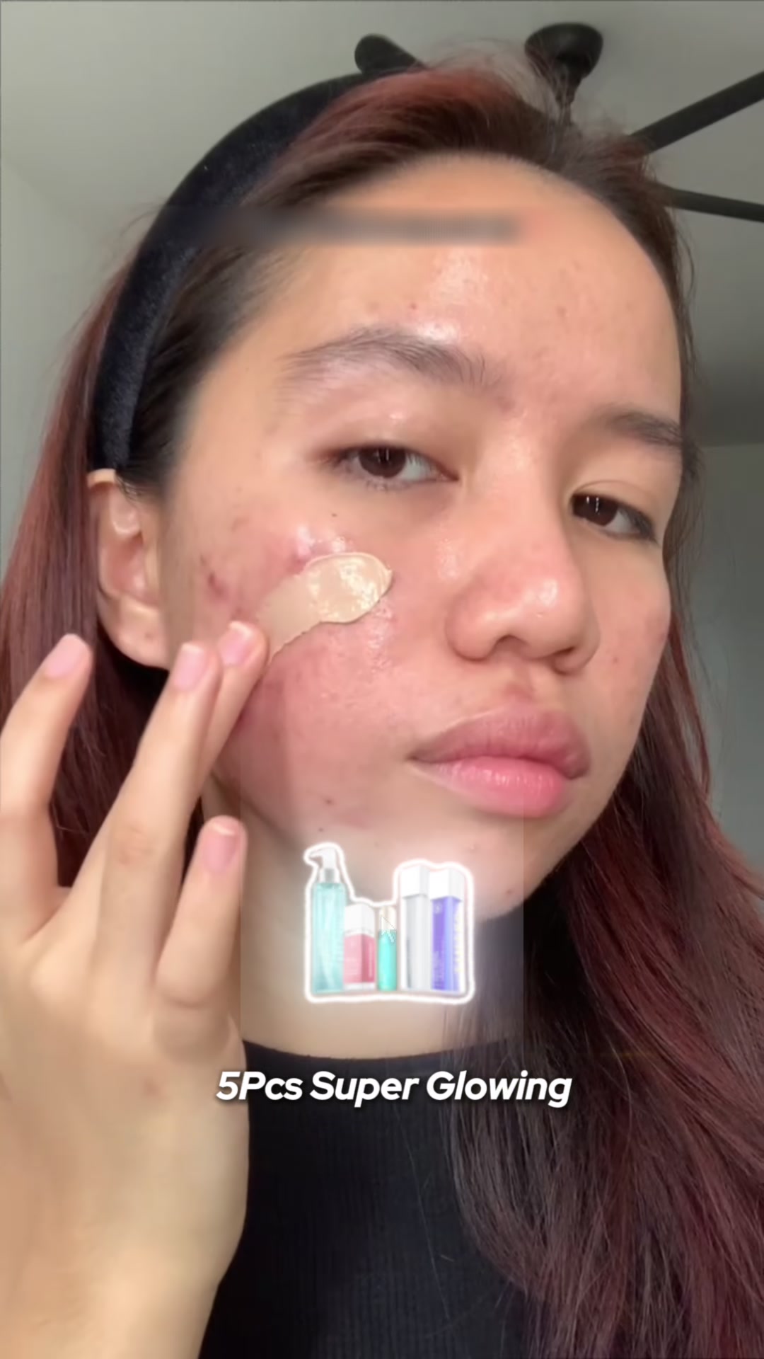 @SKINMADE