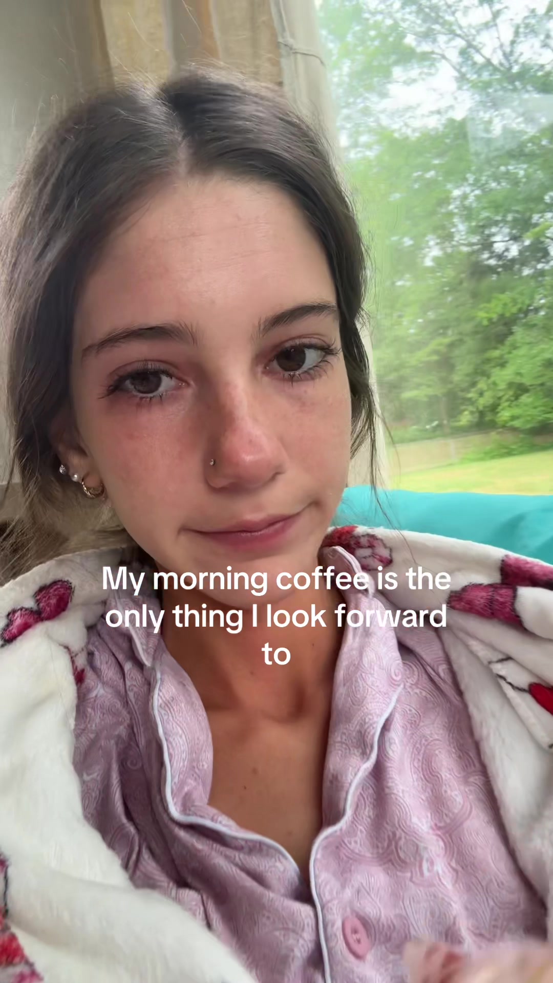 @cam