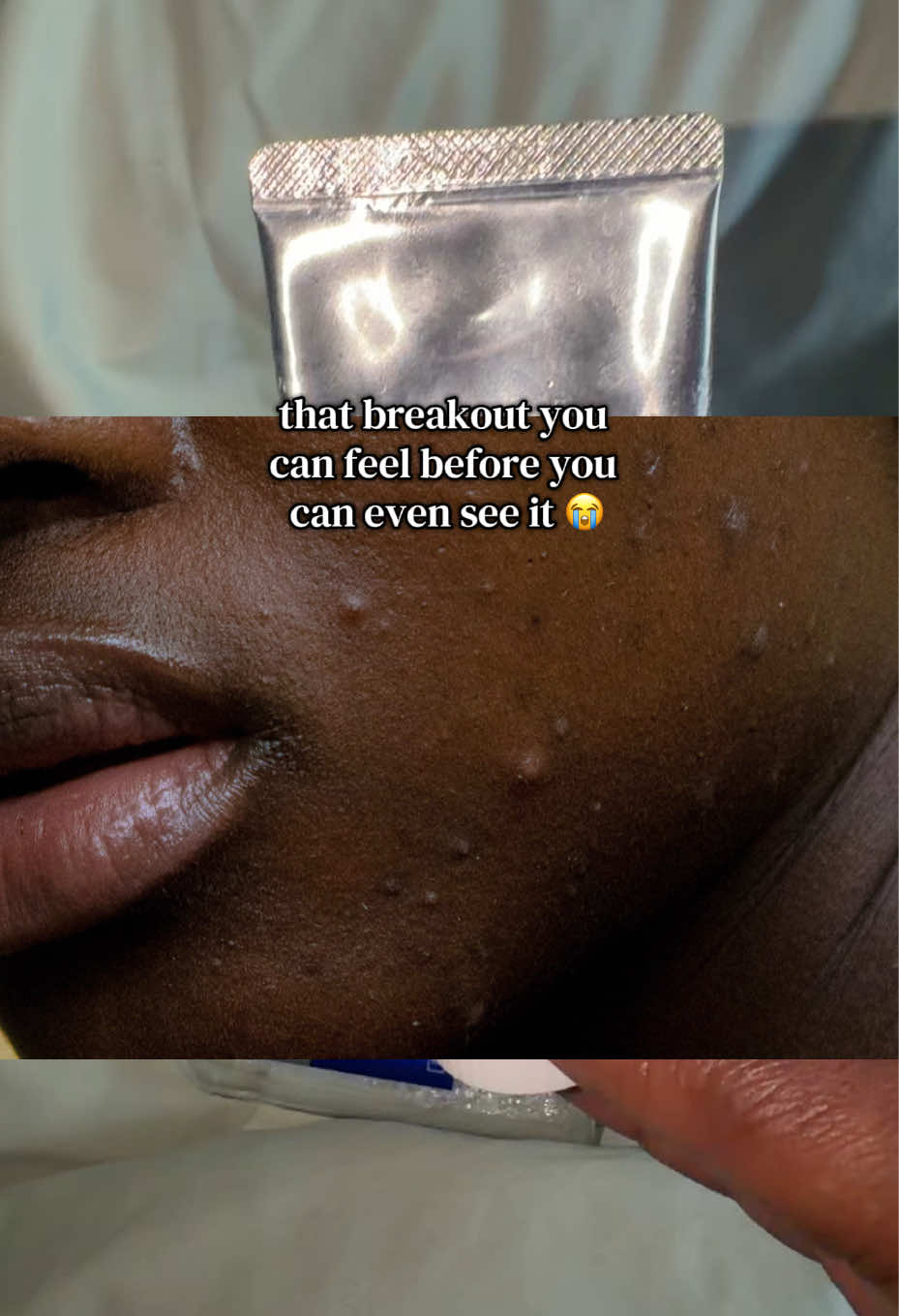 @BreadfruitGaal