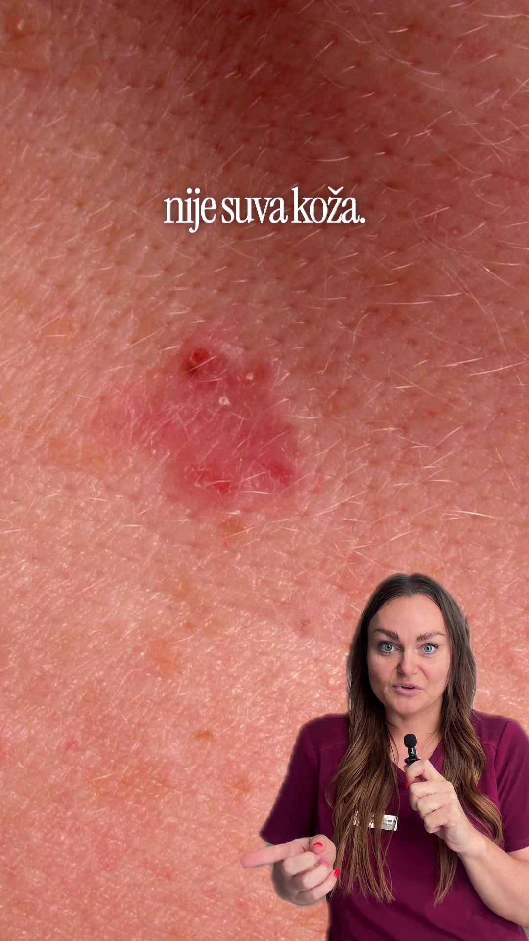@DivaLaserCentar