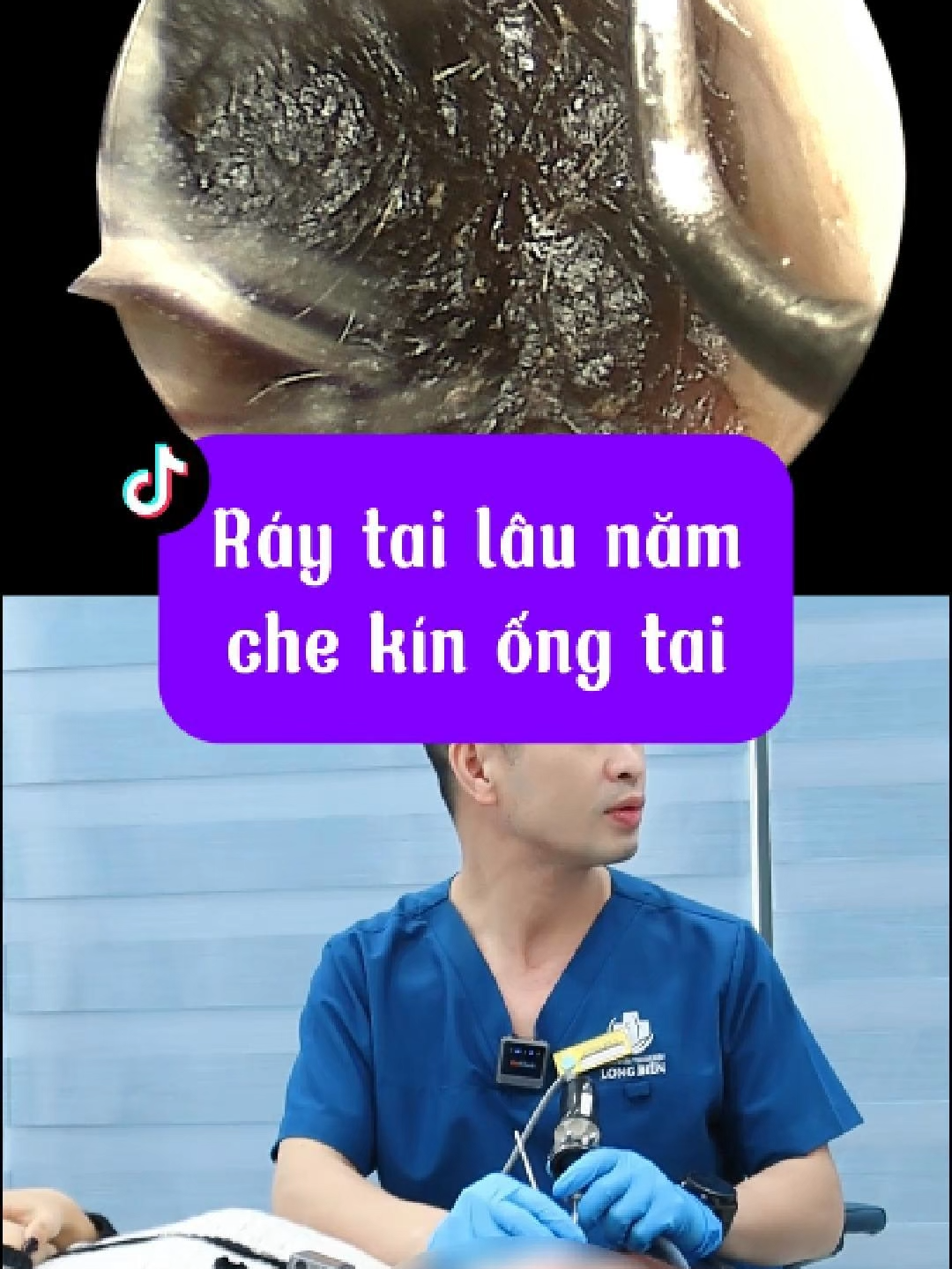 @Bs Hiệu Tai Mũi Họng Long Bi&ecirc;n
