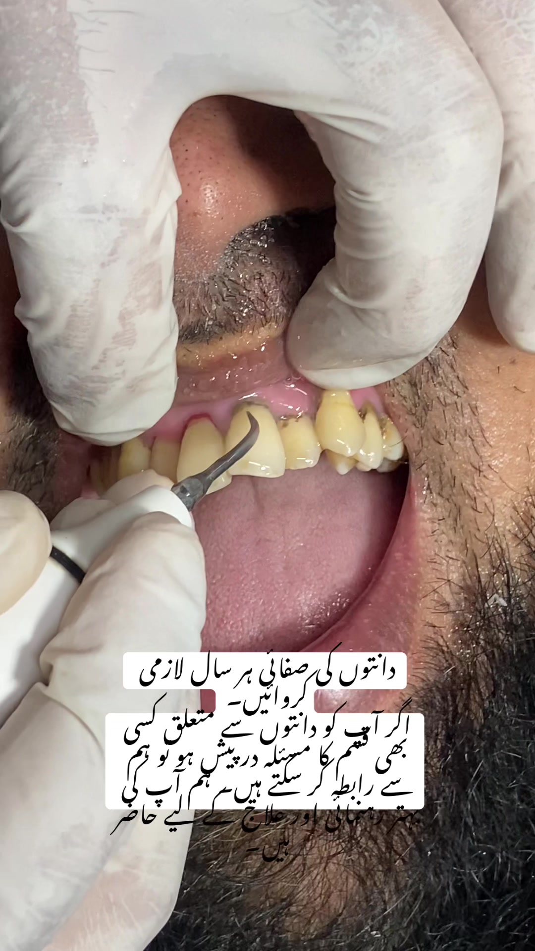 @Aun dental clinic ❤️