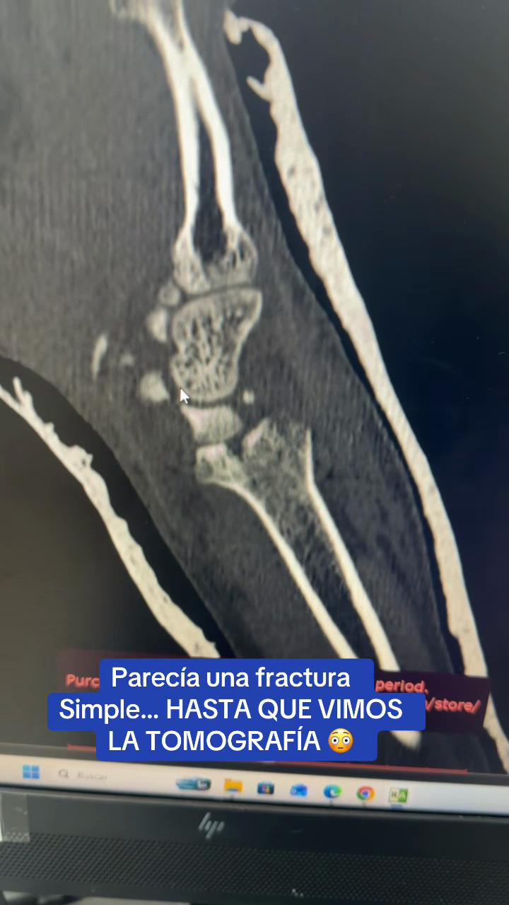 @dravasqueztraumatologia