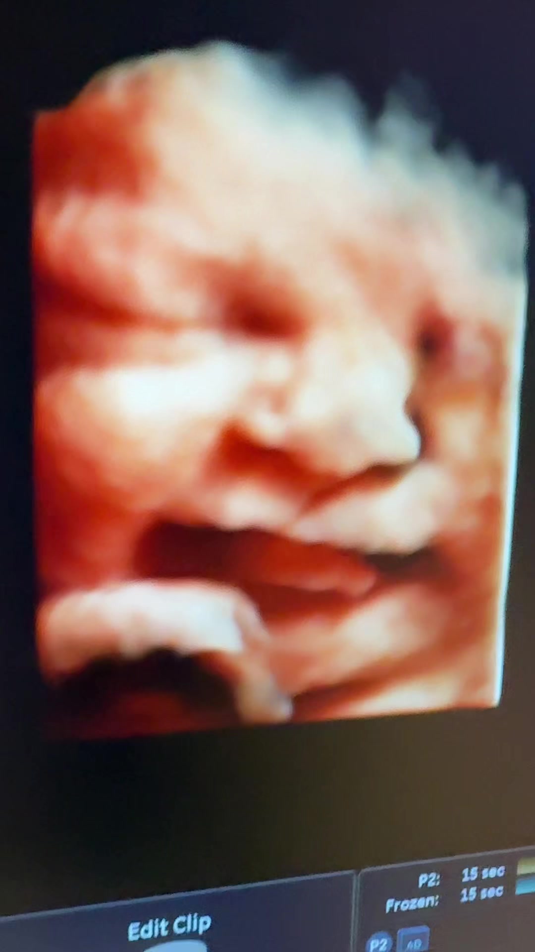@PregnantSee Inc.