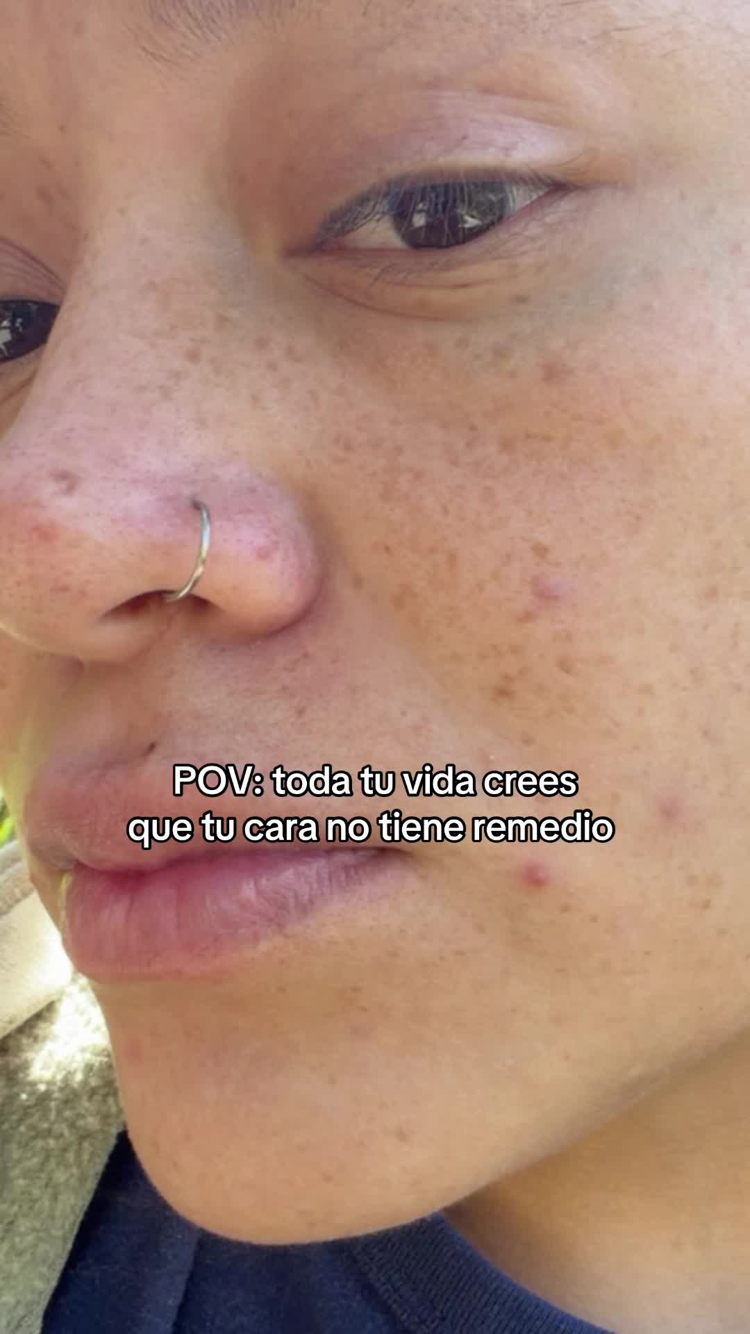 @Andy