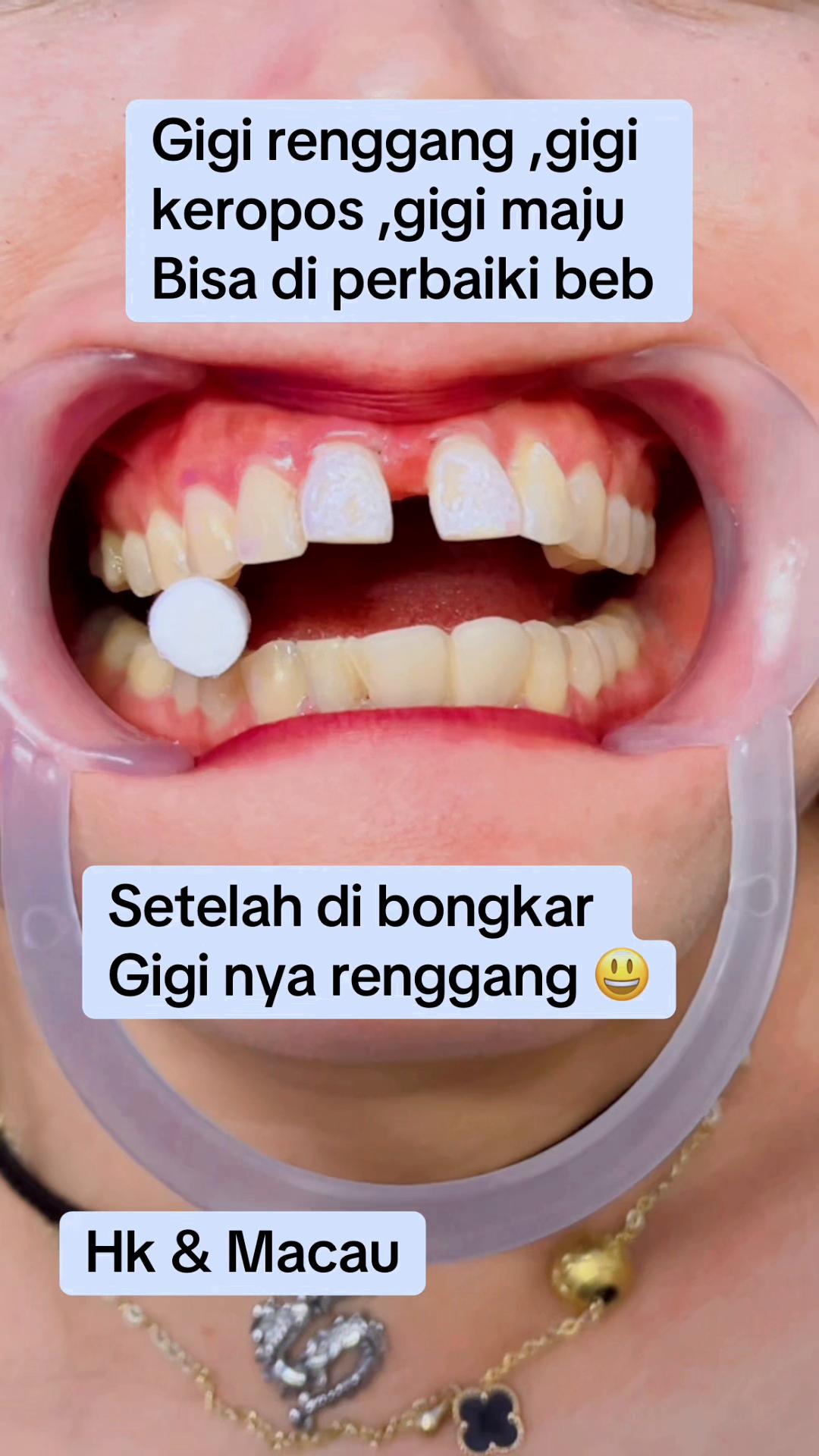 @mbak-Paijem