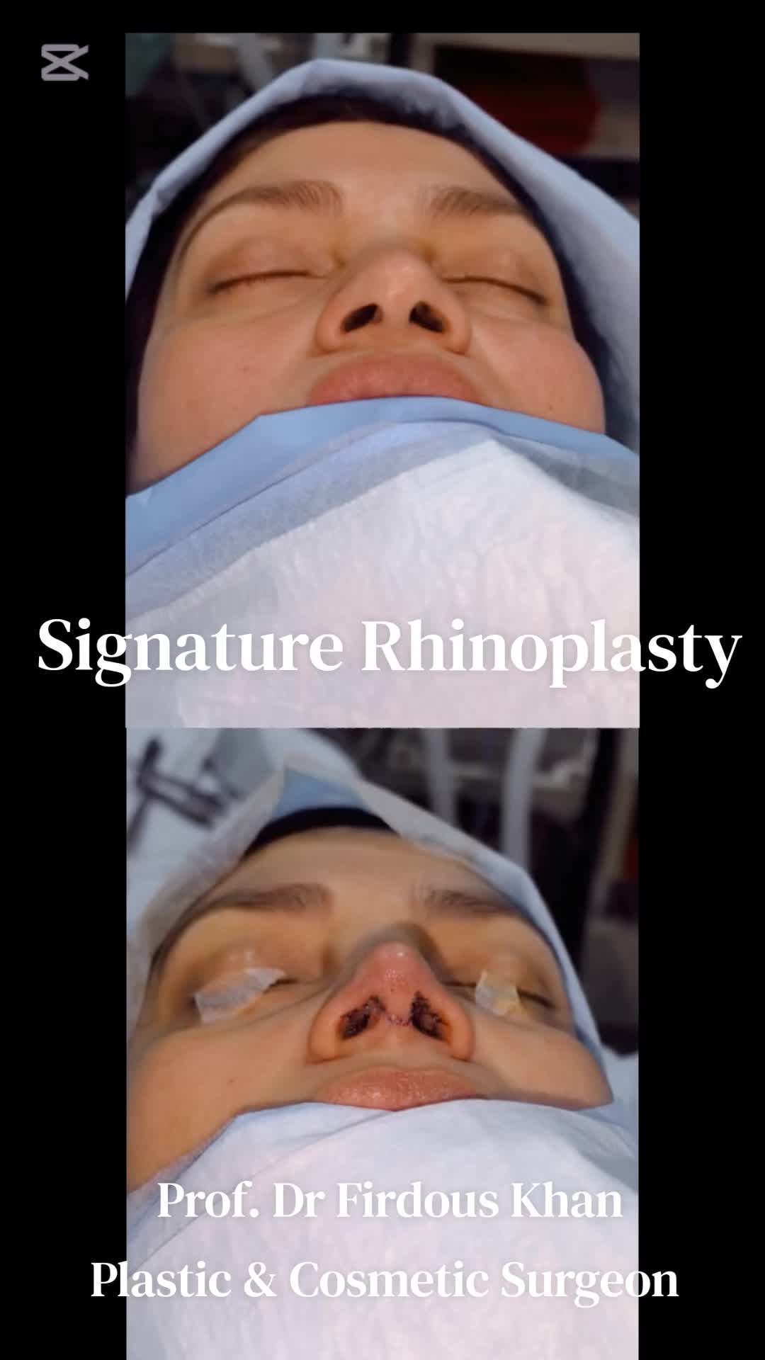 @Dr Firdous Khan PlasticSurgeon