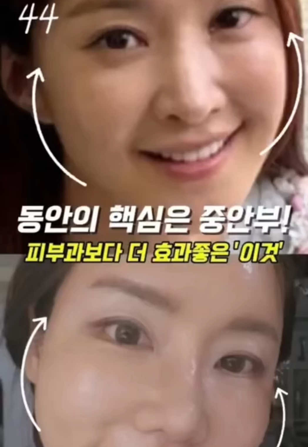 @지나스 GINAS
