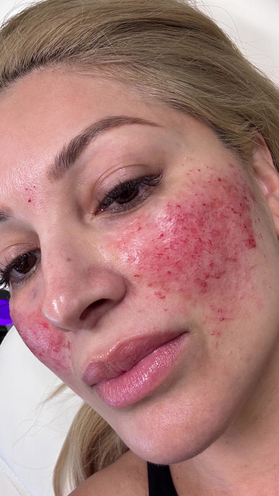 @LipDoc_OnTikTok